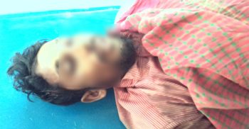 পায়রাবন্দরে ক্রেনের রশি ছিড়ে মাথায় পড়ে ১ শ্রমিক নিহত
