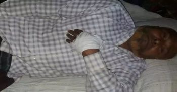 মৌলভীবাজারে সন্ত্রাসী হামলায় আহত-১