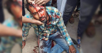 নির্বাচন কেন্দ্রে রামদার আঘাতে সাংবাদিক রক্তাক্ত