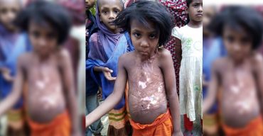 মানবিক সাহায্যে এগিয়ে আসুন ছবি দেখেই শরির কাঁপিয়ে উঠে