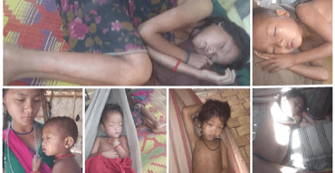 বান্দরবানে অজ্ঞাত রোগে এক শিশুর মৃত্যু, আক্রান্ত আরো ৩৫ জন