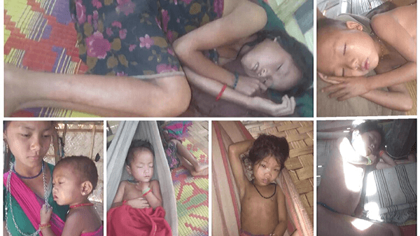 বান্দরবানে অজ্ঞাত রোগে এক শিশুর মৃত্যু, আক্রান্ত আরো ৩৫ জন