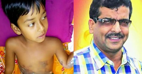 সেই অগ্নিদগ্ধ শিশুর চিকিৎসার দায়িত্ব নিলেন ঝিনাইদহ পৌরসভার মেয়র মিন্টু