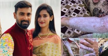 বাসায় সিলিন্ডার বিস্ফোরণ: অল্পের জন্য প্রাণে বাঁচলেন লিটনের স্ত্রী