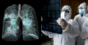 যে কারণে করোনায় পুরুষের মৃত্যুঝুঁকি বেশি