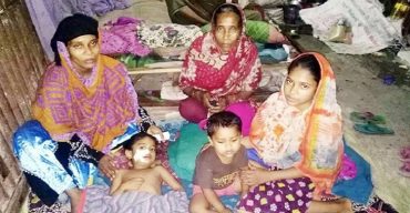 রাজাপুরে কুকুর কামড়ে নিলো শিশু তানজিলার মুখের মাংশ, অর্থাভাবে হচ্ছে না চিকিৎসা