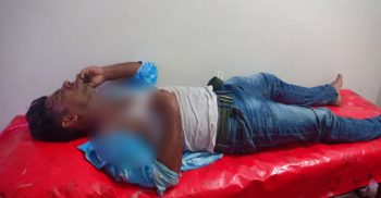 পটুয়াখালীর রাঙ্গাবালীতে সংবাদিকের ওপর সন্ত্রাসীর হামলা