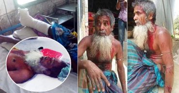 পটুয়াখালীর দশমিনায় প্রতিপক্ষের হামলায় আহত-২