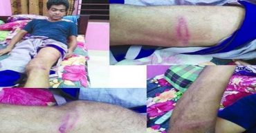 মাই টিভির সাংবাদিক পিটিয়ে জখম, পুলিশের বিরুদ্ধে প্রশাসনিক ব্যাবস্থা