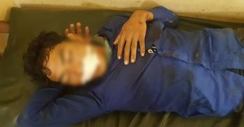 লামা রুপসীপাড়ায় মোটর সাইকেল মুখোমুখি সংঘর্ষ, দুই মুরুং যাত্রী সহ আহত ৩