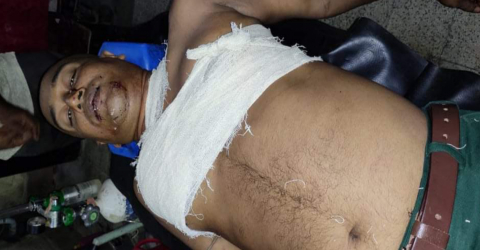 বেনাপোল বড়আচড়া গ্রামে ছোট ভাইয়ের ছুরিকাঘাত বড় ভাই গুরুতর আহত