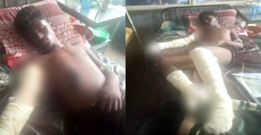 বিদ্যুৎস্পৃষ্টে গুরুতর আহত তানভীর অবস্থার অবনতি