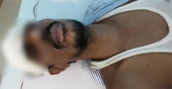 শরীয়তপুরের শৌলপাড়া ইউপি সদস্যের ওপর হামলা: আটক ৩
