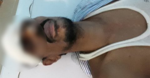 শরীয়তপুরের শৌলপাড়া ইউপি সদস্যের ওপর হামলা: আটক ৩