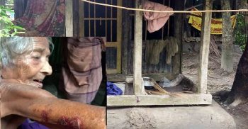 খাবার খেতে চাওয়ায় পূত্রবধূর হাতে চরম নির্যাতনের শিকার শাশুড়ি