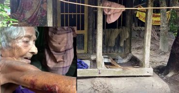 খাবার খেতে চাওয়ায় পূত্রবধূর হাতে চরম নির্যাতনের শিকার শাশুড়ি
