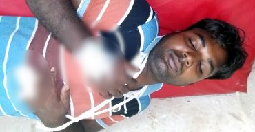 কামড় দিয়ে আঙ্গুল ছিড়ে ফেলেছে এক যুবকের