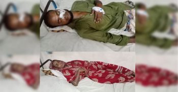 গলাচিপায় মা ছেলে মারধর হাসপাতালে ভর্তি