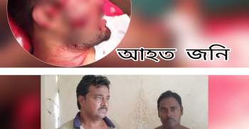 বেনাপোল সাদিপুর গ্রামে প্রতিবেশীর দায়ের আঘাতে আহত-১: গ্রেফতার-২