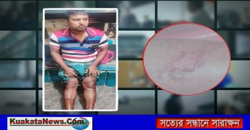 বেনাপোলে আসামীদের লোহার রডের আঘাতে বাবু গুরতর আহত,থানায় অভিযোগ দায়ের