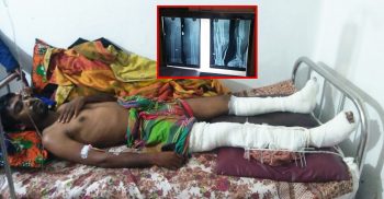 সড়ক দূর্ঘটনায় আহত বেনাপোলের এতিম লিটনকে বাঁচাতে দেশবাসীর কাছে সাহায্যের আবেদন