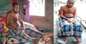 সো‌হেল রানার অসহায় জীবনযাপন; বিত্তবান‌দের পা‌শে দাঁড়া‌নোর আহ্বান