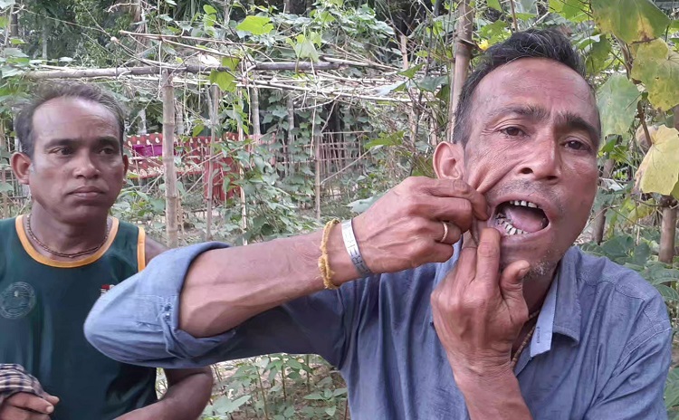 কমলগঞ্জে পূর্ব বিরোধের জের ধরে সন্ত্রাসী হামলা আহত-৩