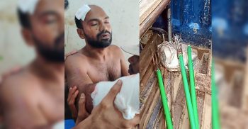 কলাপাড়ায় ছাত্রলীগ নেতার দুই হাতের রগ কর্তন