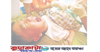 ফতুল্লায় সুন্নতে খৎনার সময় লিঙ্গ কর্তন