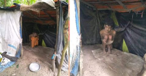 গলাচিপায় প্রতিবন্ধী কাওসারকে বাঁচাতে মা-বাবার আকুতি