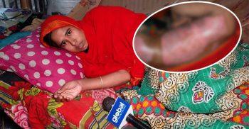 শার্শায় অগ্নিদগ্ধ মেয়েকে বাঁচাতে সাহায্যের আবেদন